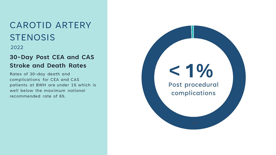 Carotid Complication Rate graphic showing fewer than 1 percent post-procedural complications