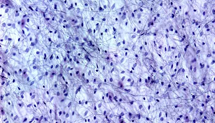 This is an image of stem cells. 