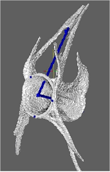 Zebrafish vertebrae morphometry 
