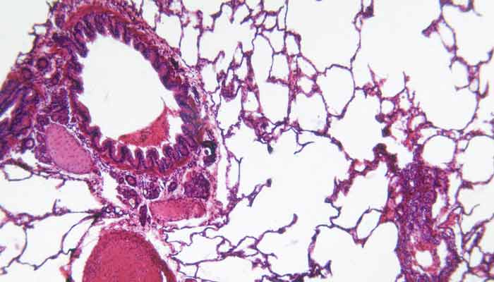 Learn more about a new study focused on asthma and minorities at Brigham and Women&rsquo;s Hospital